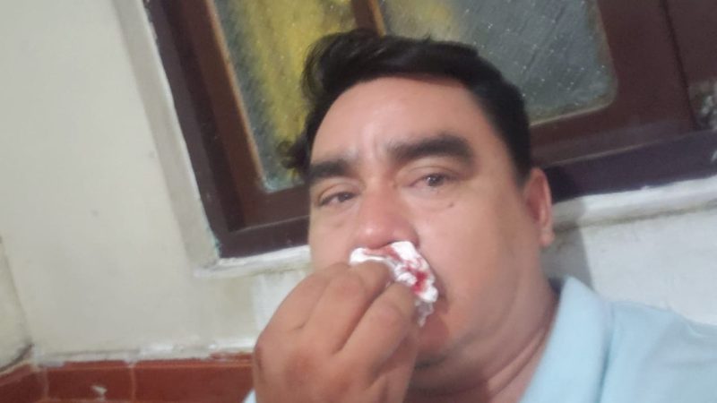 Hombre de prensa es agredido por mujeres extranjeras