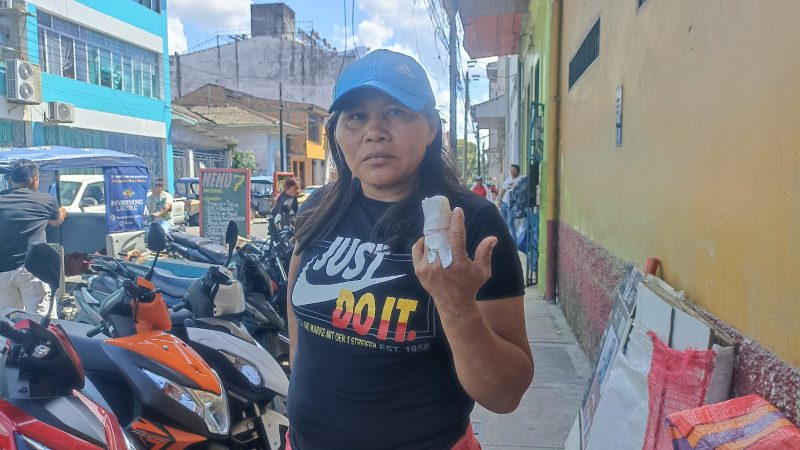 Mujer sufre fractura de dedo